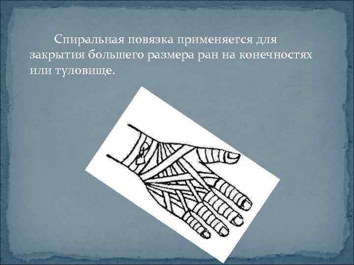 Спиральная повязка применяется для закрытия большего размера ран на конечностях или туловище. 