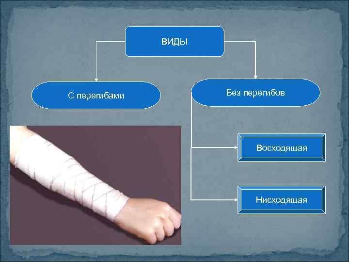 ВИДЫ С перегибами Без перегибов Восходящая Нисходящая 