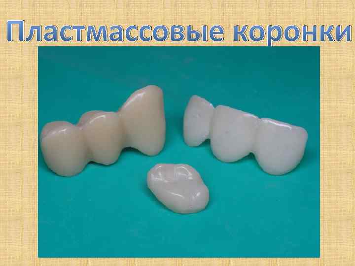 Пластмассовые коронки презентация