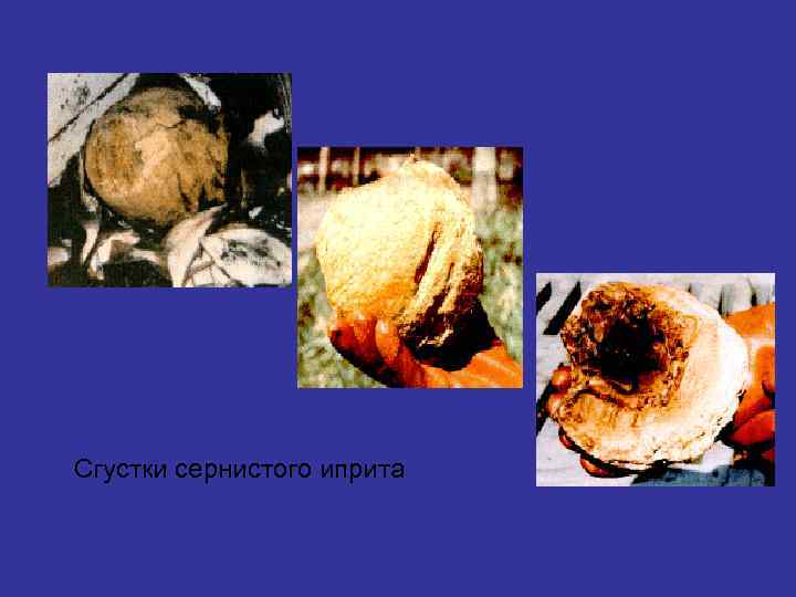 Сгустки сернистого иприта 