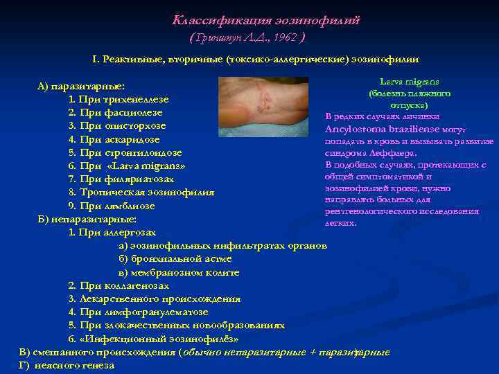 Классификация эозинофилий ( Гриншпун Л. Д. , 1962 ) I. Реактивные, вторичные (токсико-аллергические) эозинофилии