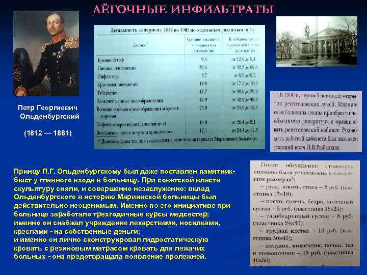ЛЁГОЧНЫЕ ИНФИЛЬТРАТЫ Петр Георгиевич Ольденбургский (1812 — 1881) Принцу П. Г. Ольденбургскому был даже