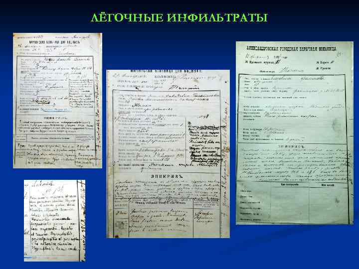 ЛЁГОЧНЫЕ ИНФИЛЬТРАТЫ 