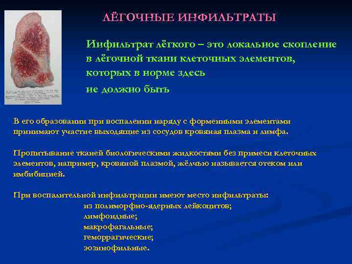 ЛЁГОЧНЫЕ ИНФИЛЬТРАТЫ Инфильтрат лёгкого – это локальное скопление в лёгочной ткани клеточных элементов, которых