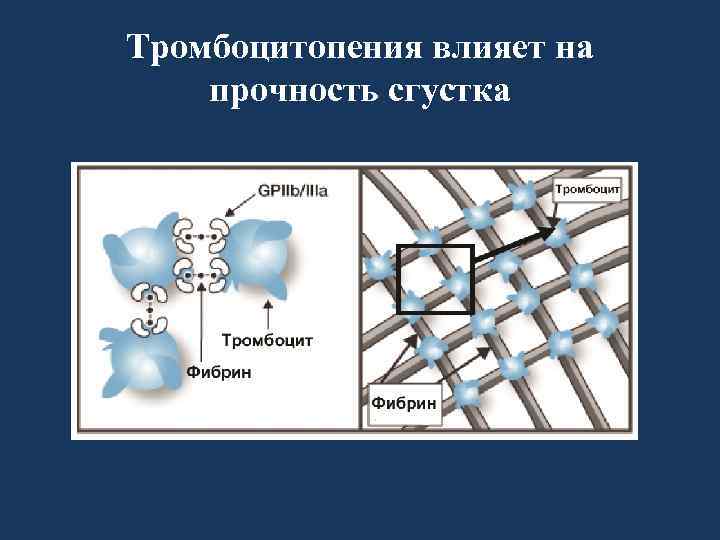 Тромбоцитопения влияет на прочность сгустка 