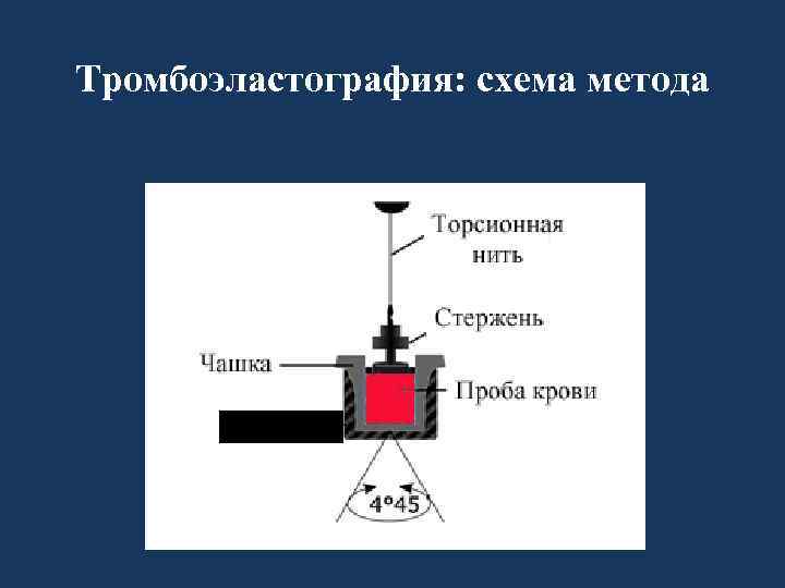 Тромбоэластография: схема метода 