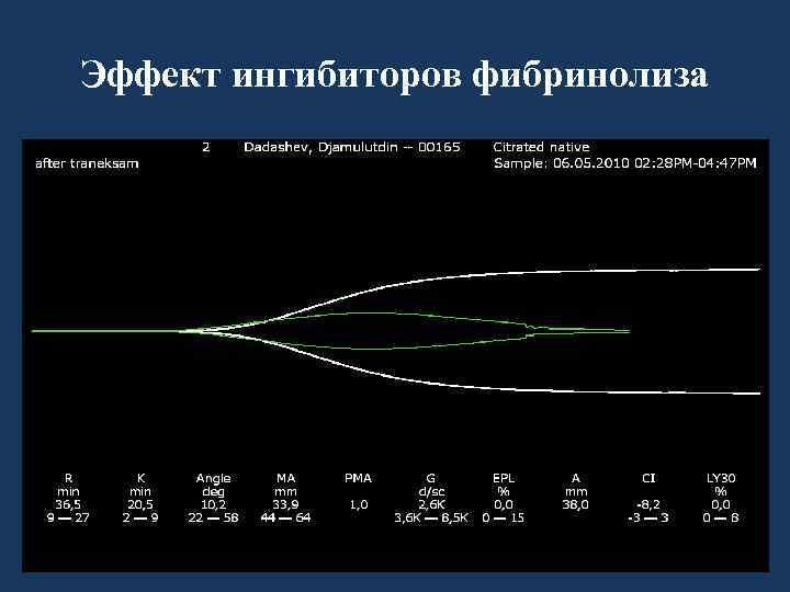 Эффект ингибиторов фибринолиза 