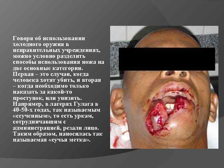 Говоря об использовании холодного оружия в исправительных учреждениях, можно условно разделить способы использования ножа