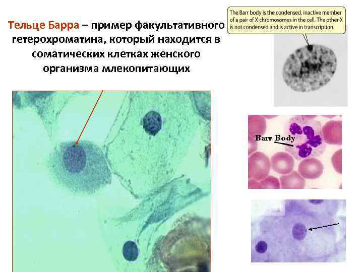 Тельца барра в клетках. Тельце Барра это в генетике. Тельце Барра в нейтрофилах. Тельца Барра генотип. Тельце Барра в клетках всех особей женского пола представляет собой.