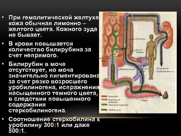  • При гемолитической желтухе кожа обычная лимонно – желтого цвета. Кожного зуда не