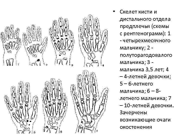  • Скелет кисти и дистального отдела предплечья (схемы с рентгенограмм): 1 - четырехмесячного