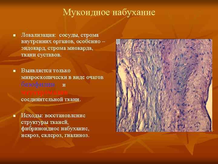 Мукоидное набухание n n Локализация: сосуды, строма внутренних органов, особенно – эндокард, строма миокарда,