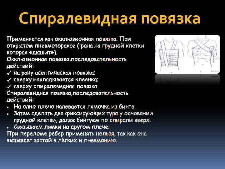 Спиралевидная повязка 