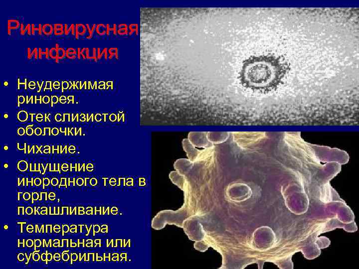 Риновирусная инфекция • Неудержимая ринорея. • Отек слизистой оболочки. • Чихание. • Ощущение инородного