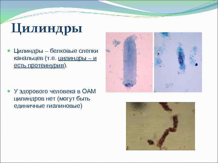 Мочевой синдром презентация