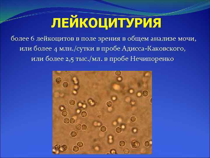 Пиурия. Лейкоцитурия это лейкоцитов поле зрения. Лейкоциты в поле зрения в моче. Лейкоцитурия в поле зрения. Пробы на лейкоциты в моче.