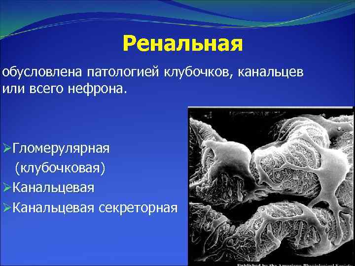 Ренальная обусловлена патологией клубочков, канальцев или всего нефрона. ØГломерулярная (клубочковая) ØКанальцевая секреторная 
