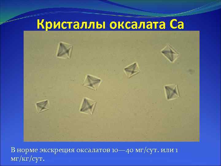 Кристаллы оксалата Са В норме экскреция оксалатов 10— 40 мг/сут. или 1 мг/кг/сут 
