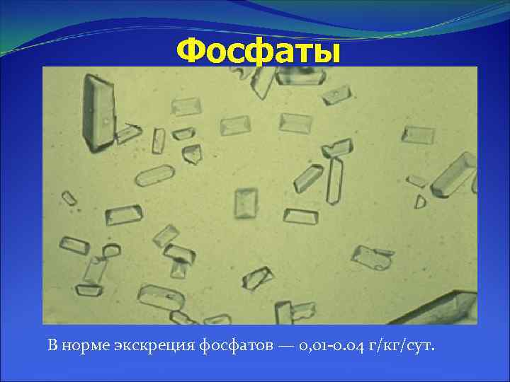 Фосфаты В норме экскреция фосфатов — 0, 01 -0. 04 г/кг/сут. 