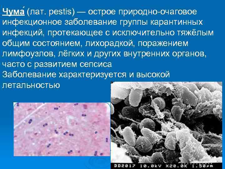Чума (лат. pestis) — острое природно-очаговое инфекционное заболевание группы карантинных инфекций, протекающее с исключительно