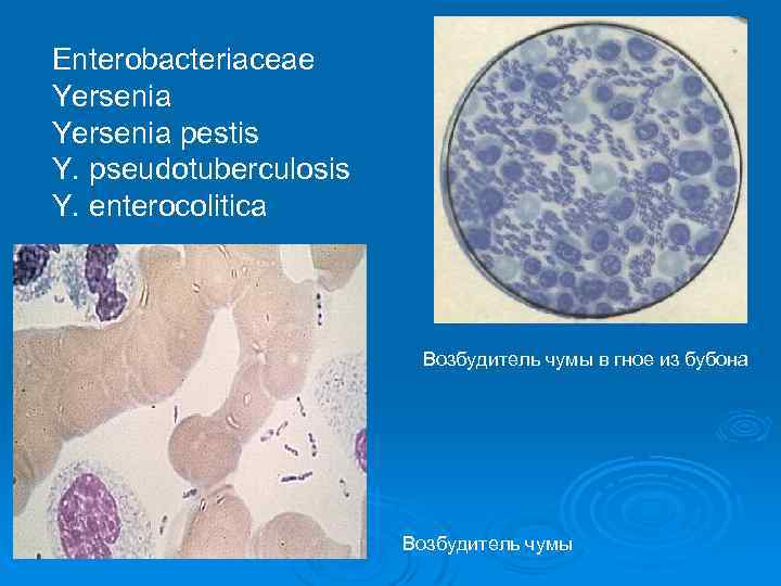 Enterobacteriaceae Yersenia pestis Y. рseudotuberculosis Y. еnterocolitica Возбудитель чумы в гное из бубона Возбудитель