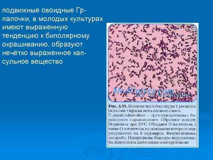 подвижные овоидные Грпалочки, в молодых культурах имеют выраженную тенденцию к биполярному окрашиванию, образуют нечётко