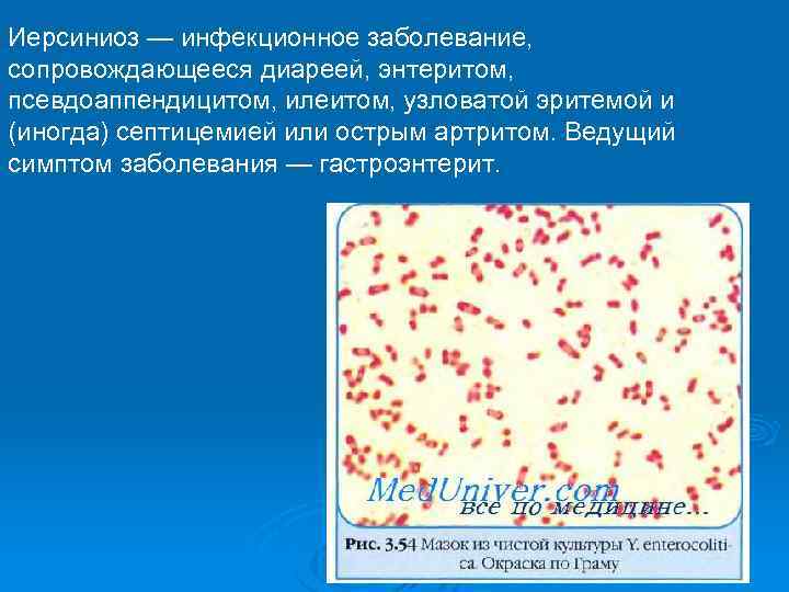 Иерсиниоз — инфекционное заболевание, сопровождающееся диареей, энтеритом, псевдоаппендицитом, илеитом, узловатой эритемой и (иногда) септицемией