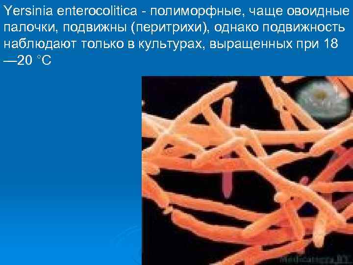 Yersinia enterocolitica - полиморфные, чаще овоидные палочки, подвижны (перитрихи), однако подвижность наблюдают только в