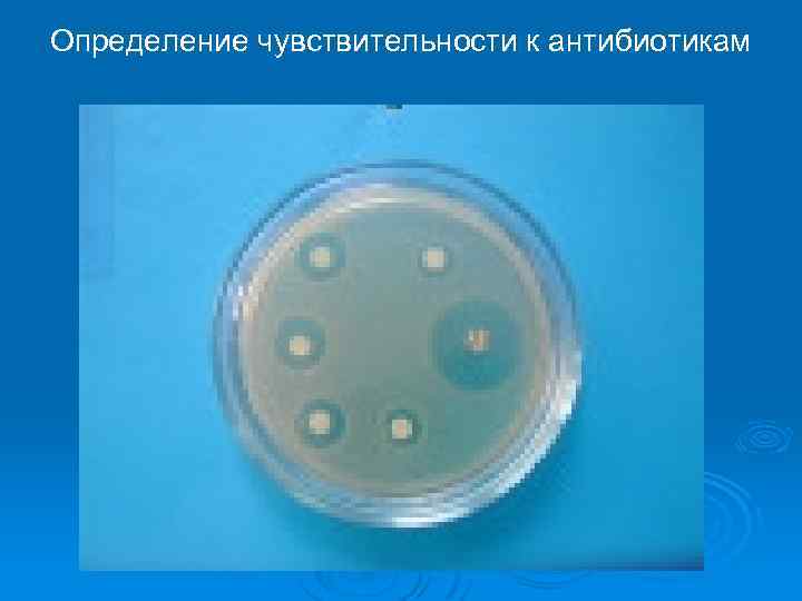 Определение чувствительности к антибиотикам 