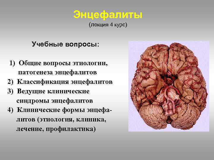 Энцефалиты (лекция 4 курс) Учебные вопросы: 1) Общие вопросы этиологии, патогенеза энцефалитов 2) Классификация