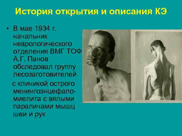 История открытия и описания КЭ • В мае 1934 г. начальник неврологического отделения ВМГ