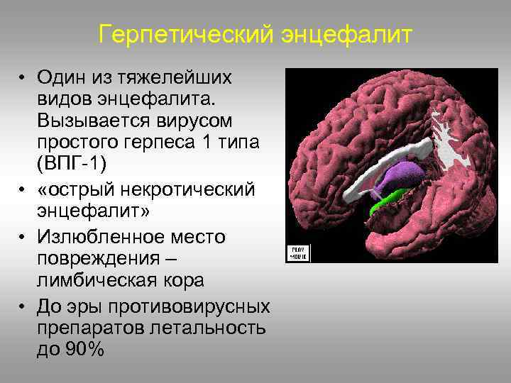 Герпетический энцефалит • Один из тяжелейших видов энцефалита. Вызывается вирусом простого герпеса 1 типа