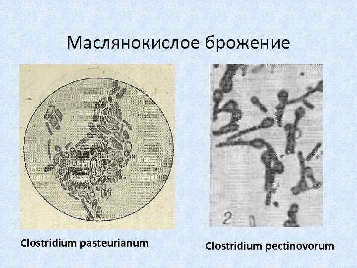 Маслянокислое брожение Clostridium pasteurianum Сlostridium pectinovorum 