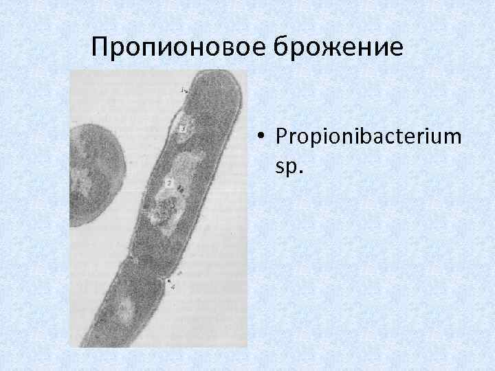 Пропионовое брожение • Propionibacterium sp. 