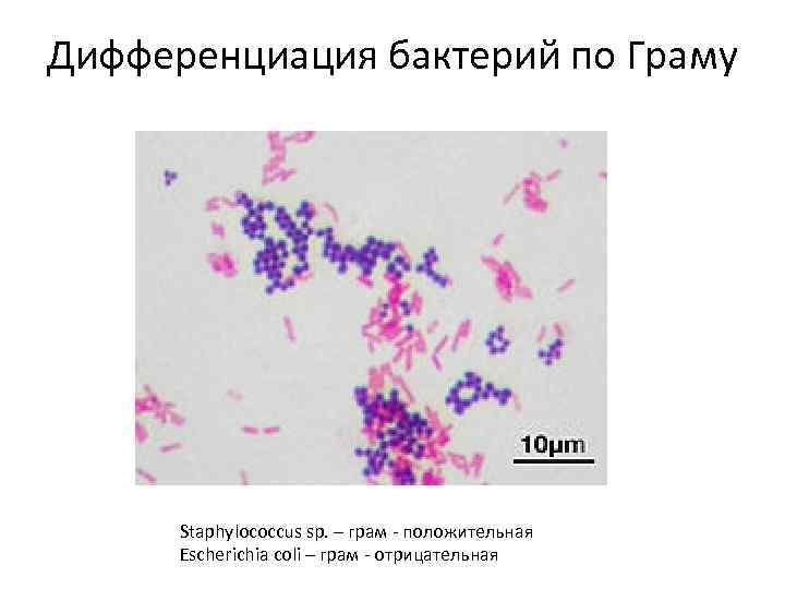 Дифференциация бактерий по Граму Staphylococcus sp. – грам - положительная Escherichia coli – грам