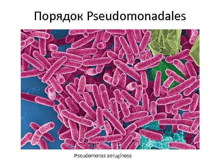 Порядок Pseudomonadales Pseudomonas aeruginosa 