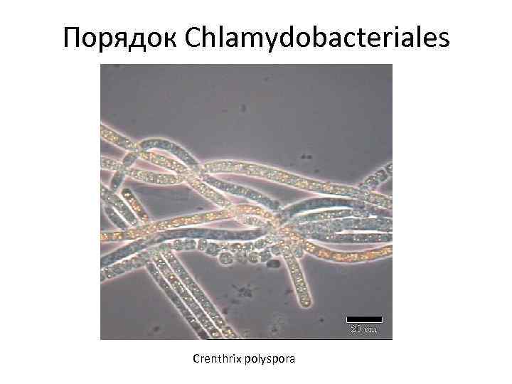 Порядок Chlamydobacteriales Crenthrix polyspora 