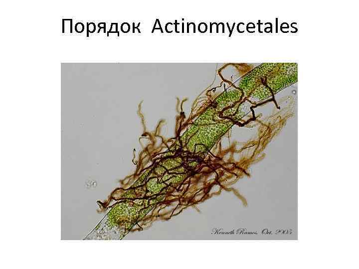 Порядок Actinomycetales 