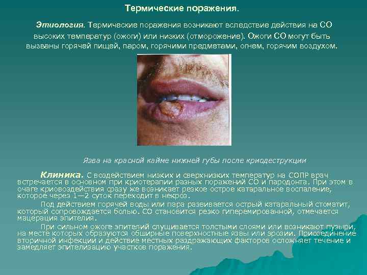 Термические поражения. Этиология. Термические поражения возникают вследствие действия на СО высоких температур (ожоги) или
