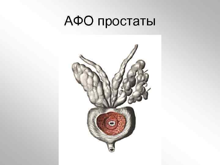 АФО простаты 