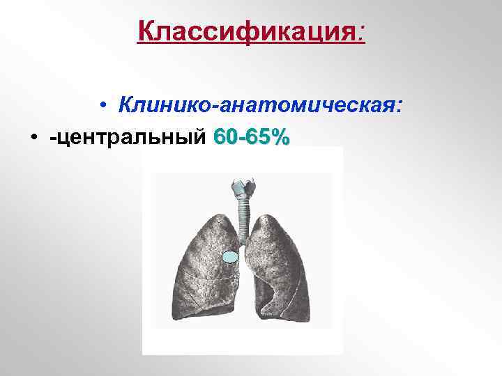 Классификация: • Клинико-анатомическая: • -центральный 60 -65% 