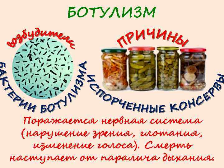 БОТУЛИЗМ Поражается нервная система (нарушение зрения, глотания, изменение голоса). Смерть наступает от паралича дыхания.