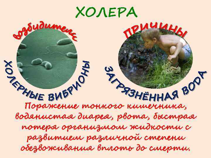 ХОЛЕРА Поражение тонкого кишечника, водянистая диарея, рвота, быстрая потеря организмом жидкости с развитием различной