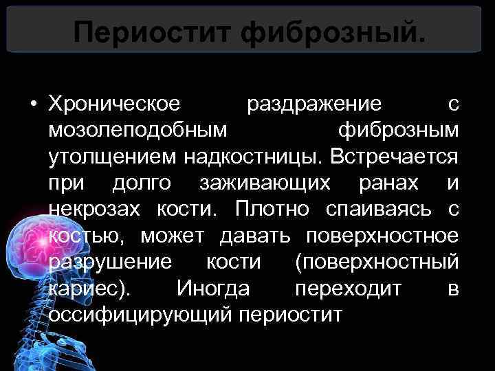 Периостит фиброзный. • Хроническое раздражение с мозолеподобным фиброзным утолщением надкостницы. Встречается при долго заживающих