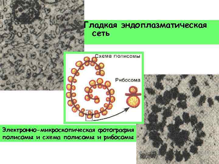 Гладкая эндоплазматическая сеть Электронно-микроскопическая фотография полисомы и схема полисомы и рибосомы 