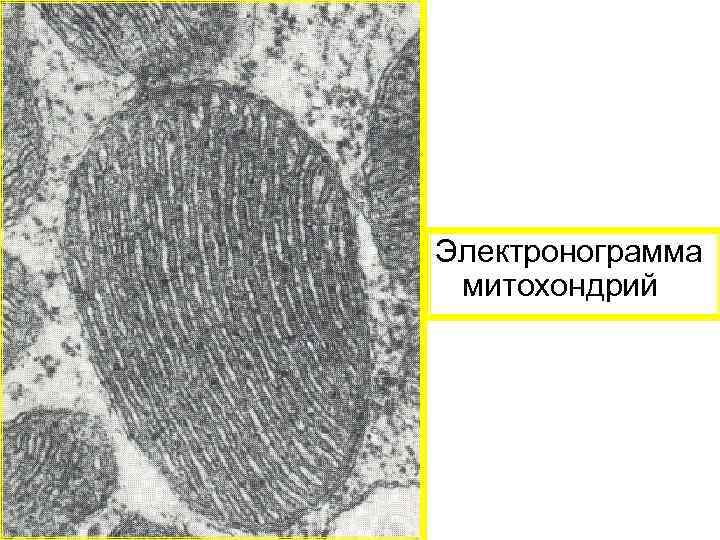 Электронограмма митохондрий 