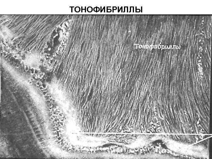 ТОНОФИБРИЛЛЫ 