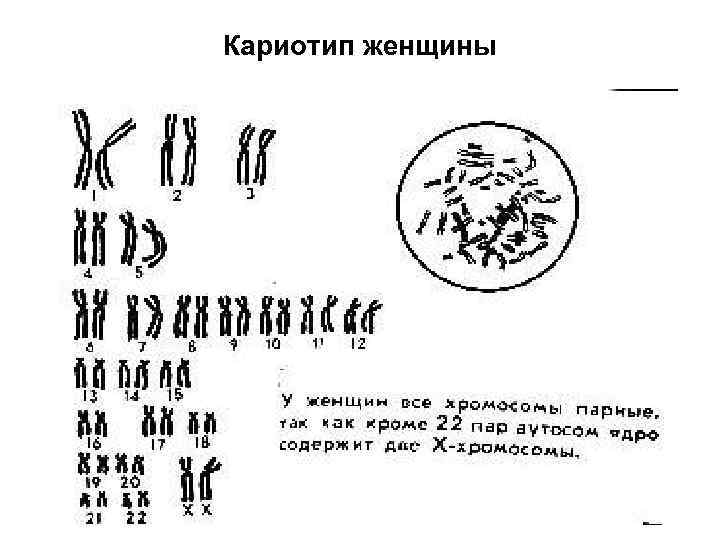 Кариотип женщины 