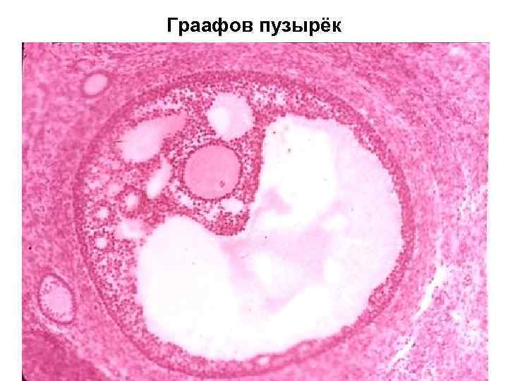 Граафов пузырёк 