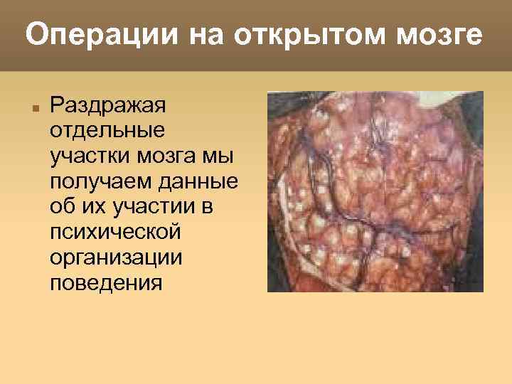 Операции на открытом мозге Раздражая отдельные участки мозга мы получаем данные об их участии